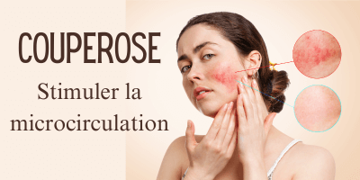 Couperose: stimuler la micro-circulation